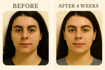 Olumora™ Silicone Renewal Tape