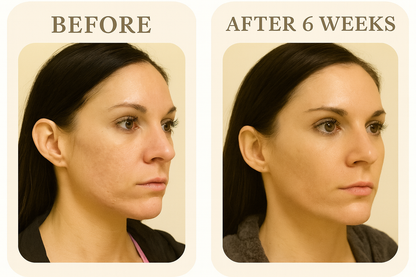 Olumora™ Silicone Renewal Tape