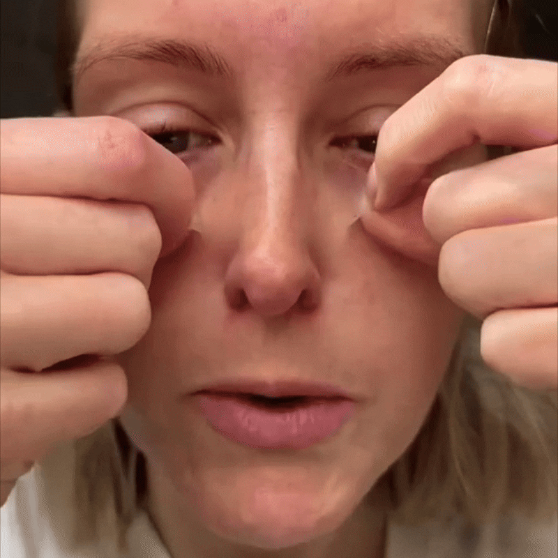 Why Costly Procedures Aren't Your Only Option